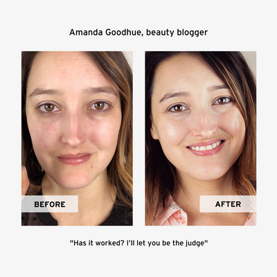 The Essentials (3-Product Routine)