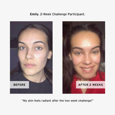 Emily's Before and After using No BS Skincare COQ10 Antioxidant Cream 