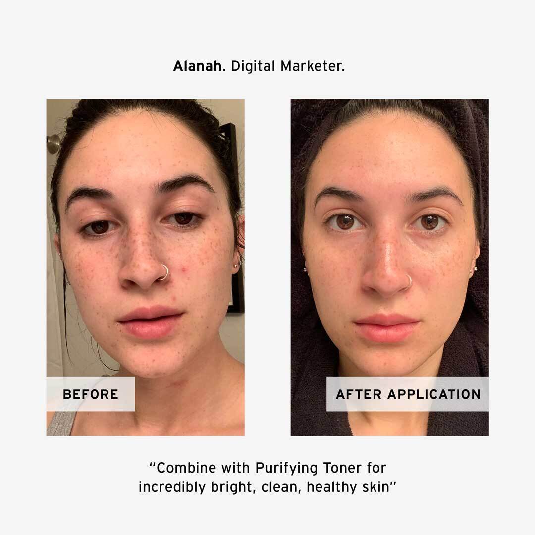 Alanah's No BS Skincare Foaming Cleanser Before and After