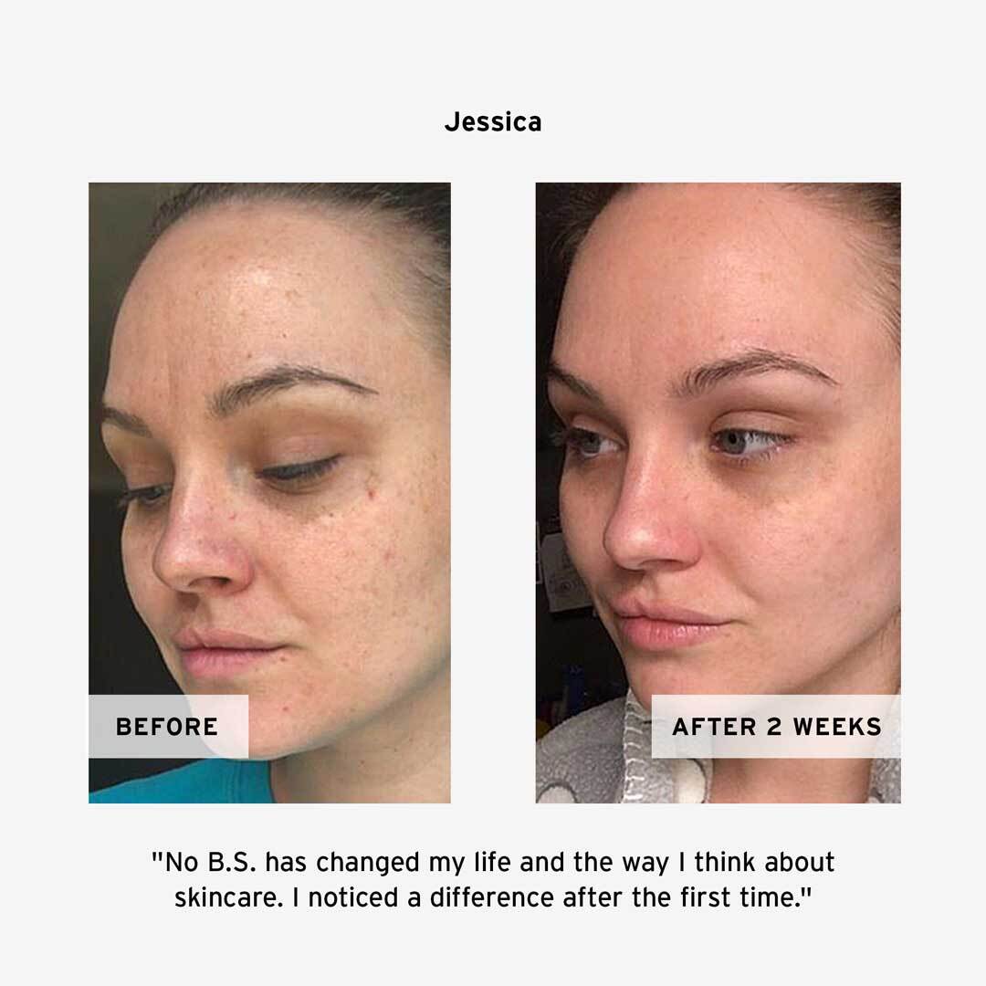 Jessica's No BS Hyaluronic Day + Night Cream  Before and After