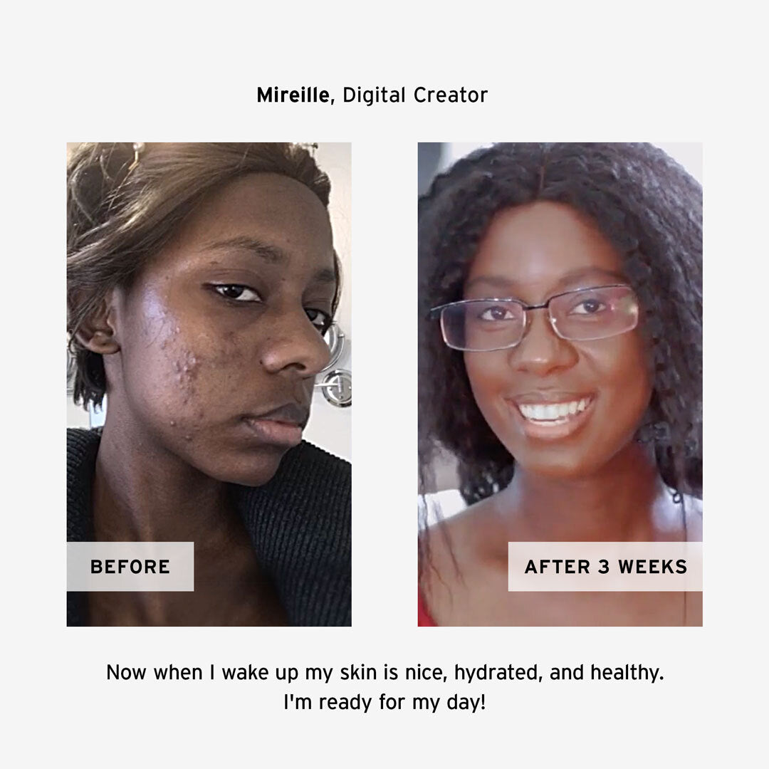 Retinol Night Cream.