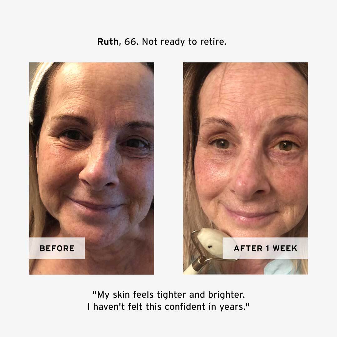 Ruth's No BS Skincare Retinol Night Cream Before and After