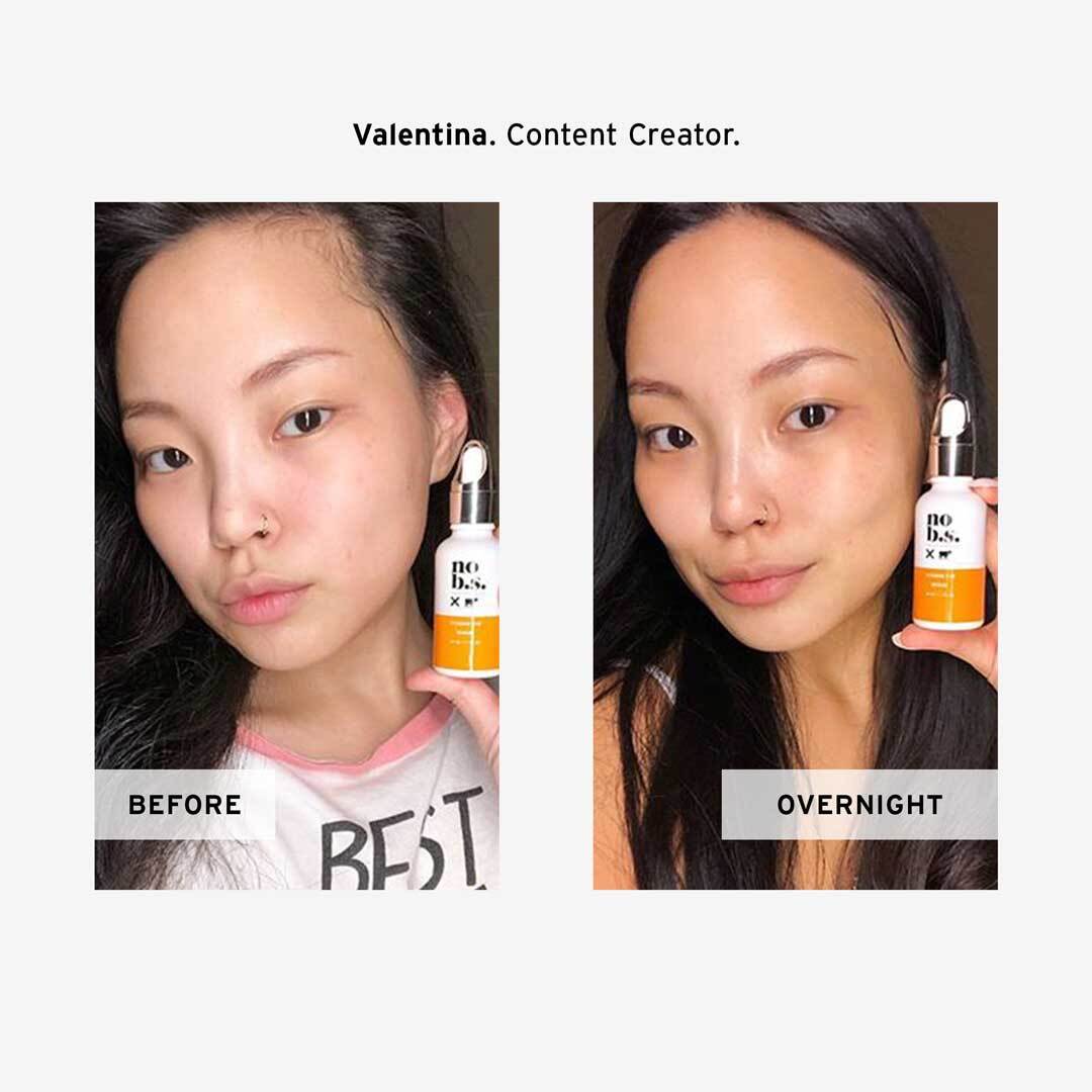 Valentina's No BS Skincare Vitamin C + E Serum   Before and After