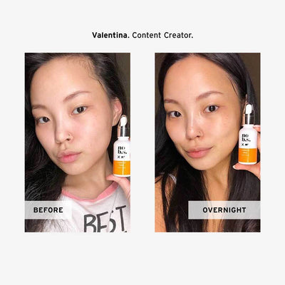 Vitamin C + E Serum.